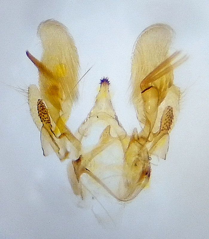 Hypatima zesticopa